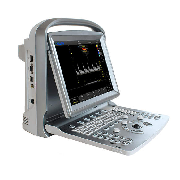 CHISON SonoTouch 20 (ECO 5)