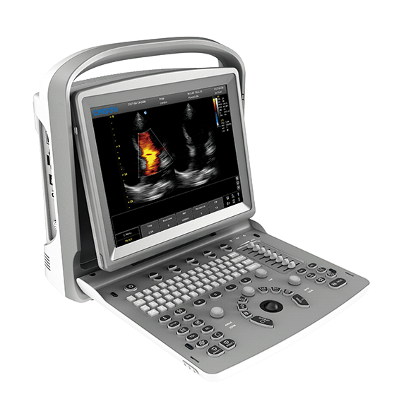 CHISON SonoTouch 50 (ECO 6)