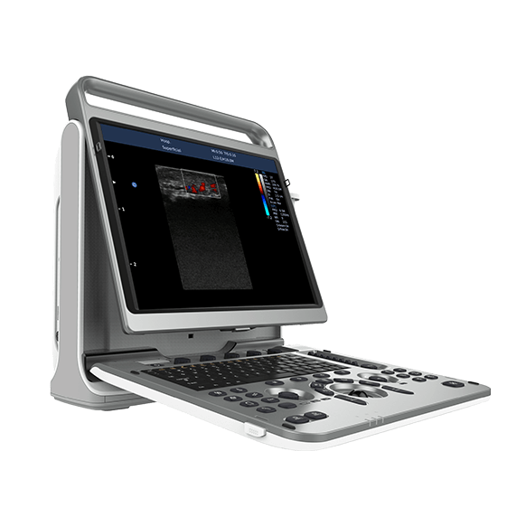CHISON SonoTouch 60