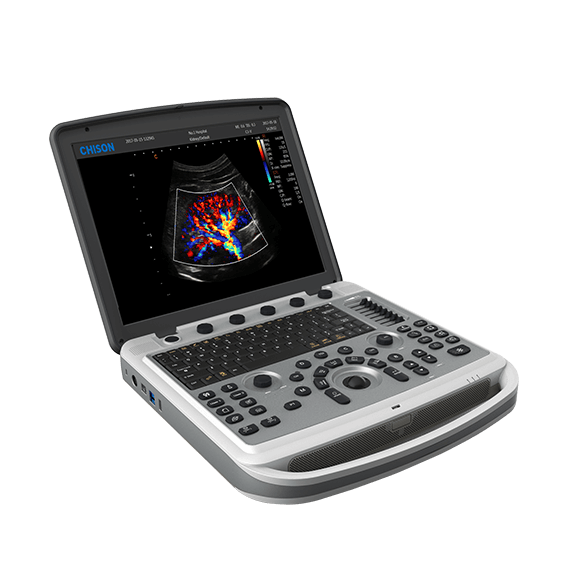 CHISON SonoTouch 80 (SonoBook 6)