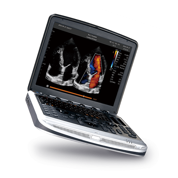 CHISON SonoTouch 80 (SonoBook 8)
