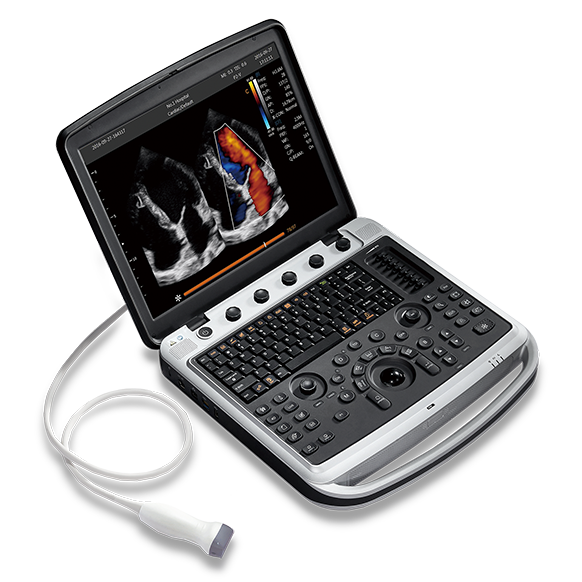 CHISON SonoTouch 80 (SonoBook 9)