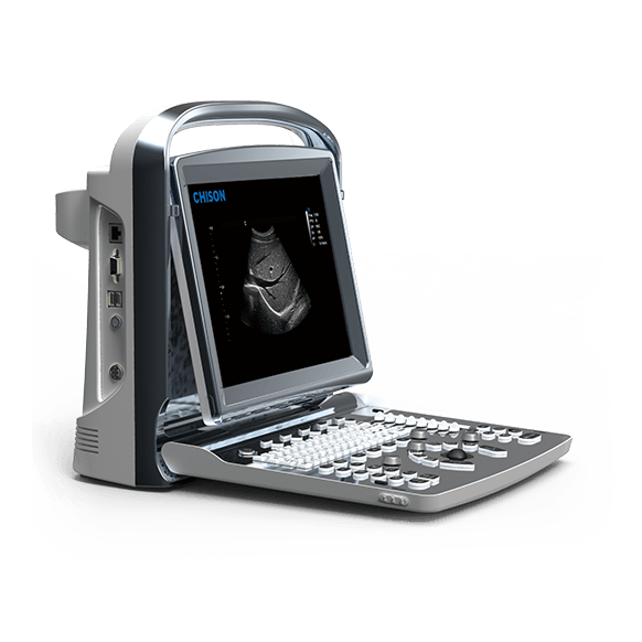 CHISON SonoTouch 10
