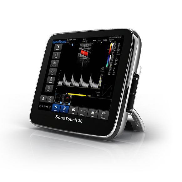 CHISON SonoTouch 30 (ECO 3)